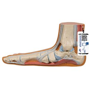 Modello di Piede Piatto (Pes planus) - Ossa, Muscoli & Legamenti Modello di Piede Piatto (Pes planus) - Ossa, Muscoli & Legamenti