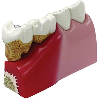 3B Scientific GPI Anatomicals 2860 Modello di Denti 3B Scientific GPI Anatomicals 2860 Modello di Denti