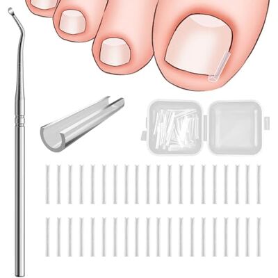 DMNQ 40 Pcs Unghie Incarnite Piedi Strisce Correttore Per Unghie Incarnite Unghie Piedi Incarnite Unghie Incarnite Piedi Unghie Incarnite Piedi Attrezzi Per Pedicure Con Sollevatore Per Unghie Incarnite DMNQ 40 Pcs Unghie Incarnite Piedi Strisce Correttore Per Unghie Incarnite Unghie Piedi Incarnite Unghie Incarnite Piedi Unghie Incarnite Piedi Attrezzi Per Pedicure Con Sollevatore Per Unghie Incarnite