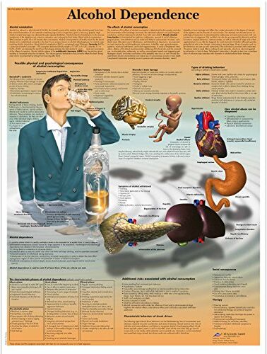 3B Scientific Anatomia umana - Grafico di dipendenza da alcol, versione cartacea