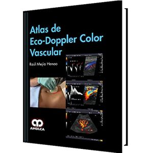 Mejía Atlas de Eco-Doppler Color Vascular (Spanish Edition) Mejía Atlas de Eco-Doppler Color Vascular (Spanish Edition)