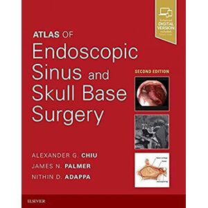 Adappa MD, Nithin D Atlas of Endoscopic Sinus and Skull Base Surgery Adappa MD, Nithin D Atlas of Endoscopic Sinus and Skull Base Surgery