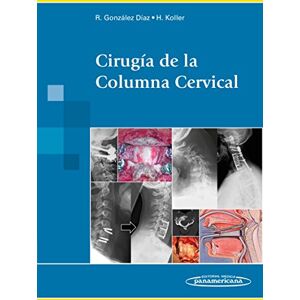 González Díaz, Rafael Cirugía de la columna cervical González Díaz, Rafael Cirugía de la columna cervical