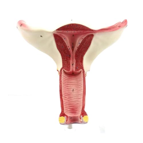 YUYAO Orgelmodel Menselijk Anatomie Model Vrouwelijke voortplantingsorgaan Model Baarmoeder Eierstok Eileider Ziekte Anatomie Model voor Onderwijs, Onderzoek Anatomiemodel