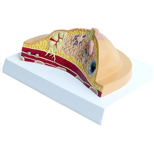 NURCIX Menselijk Model Vrouwelijke Borst Anatomisch Model, Anatomie Ziekte Kanker Pathologisch Borst Model, Pathologische Borst Cross-Sectie Anatomisch Model Skelet Model