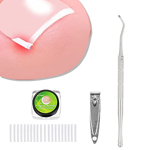 Yunmoxiao (24 +2) Ingegroeide teennagel correctie behandeling kit, 24 stuks ingegroeide teennagel Corrector Straightener Strips Recover Clips met 2 stuks ingegroeide teennagel bestand en lifter