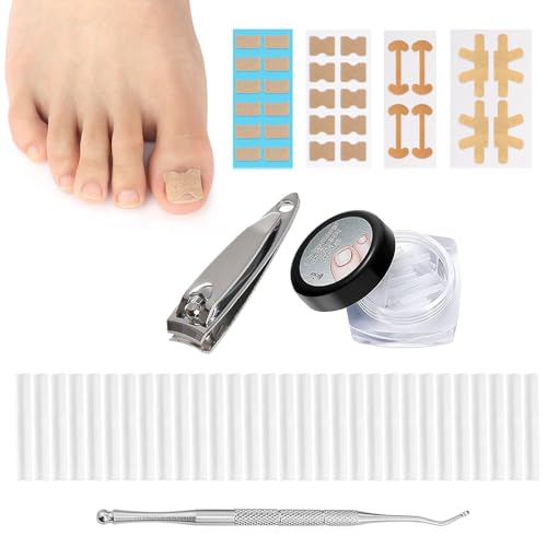 SEMINISMAR Teennagelcorrectie, ingegroeide teennagels, gereedschapsset, teennagelpatches, corrector pedicuregereedschap, correctiestickers, teennagelgladder, correctiepatch, met teennagelpatches, 30 stuks