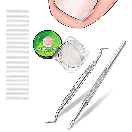 Jocaluyia Ingegroeide teennagel Tool Kit, RVS teennagel vijl lifters met opbergkoffer, 50 stuks zachte ingegroeide teennagel strips, professionele pedicure tools voor behandeling schoon vuil voorkomen ingegroeide teennagels