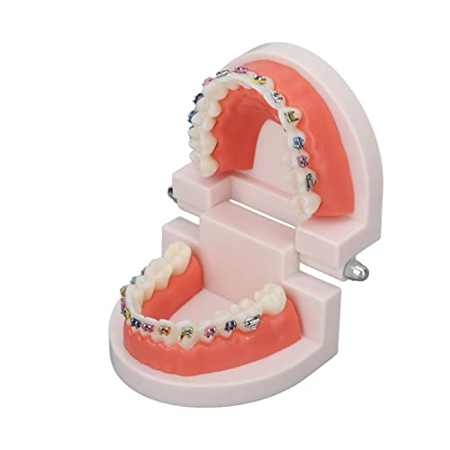 Tyenaza Orthodontisch tandenmodel, Typodonts Orthodontie demonstratiemodel met metalen draden en beugel Onderwijs-, leer-, interpretatiemodel voor volwassenen en kinderen