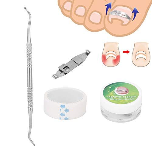 Ruiqas 3 stks Ingegroeide Teennagel Corrector Paronychia Behandeling Nagel Correctie Gesp Plakband Set