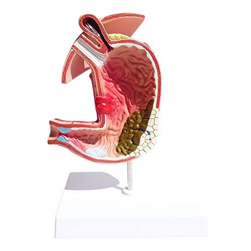 JSGDF Menselijk maagmodel Maagziekten Anatomiemodel Menselijk spijsverteringsstelsel Anatomisch model en educatief materiaal voor school, onderwijs