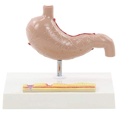 FLYIFE Menselijk orgel anatomisch model levensgrote maag anatomie model anatomische pathologische maag leer- en leerhulpmiddelen voor laboratoriumbenodigdheden