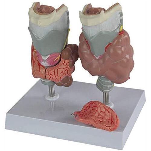 UNbit Wetenschapsmodellen van Menselijke Anatomie Model van Schildklieraandoening, Schildklieraandoening van Anatomiemodel Medisch Model van Endocriene Aandoening