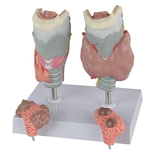 HYCLAM Medische Modellen, Menselijke Anatomie Wetenschap Modellen Schildklier Pathologie Model Menselijke Schildklier Zieke Anatomie Model Ziekte Display Model