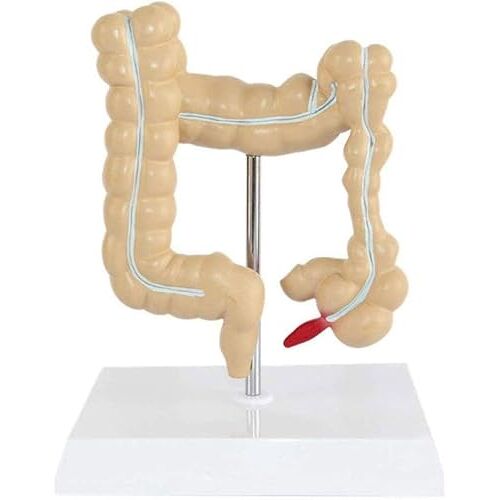 EsaSaM Model voor colorectaal menselijk colonletsel, model voor pathologische ziekten van de dikke darm, voor onderwijshulpmiddel voor medisch onderwijs