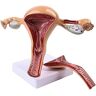 DACUDA Onderwijsmodel, Baarmoeder Anatomisch Model 2 Onderdelen Baarmoeder Anatomisch Model Baarmoeder Eierstok Menselijke Vrouw Model Anatomie van Vrouwelijke Interne