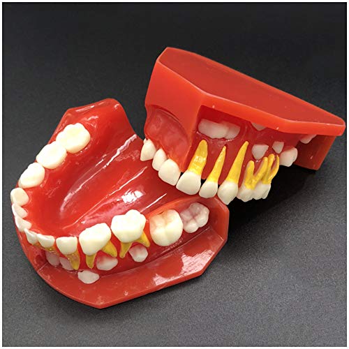 FHUILI Child Melktanden Model Teeth onderwijs model Simulatie Oral Tooth Wisselende melkgebit Model Dental Tanden Studie Onderwijs Model tanden model voor het onderwijs,A