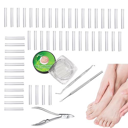 Zankie Ingegroeide teennagel Corrector Kit,Gebogen teennagelcorrector, nagelcorrectie C-vorm teennagelknipper   Met Ingegroeide Teennagel Lifter Gebogen Teennagel Corrector Voor Pedicure Tool