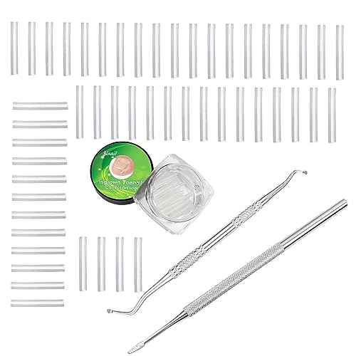 Decorhome Nagelcorrectieset,Nagelcorrectietool, professionele C-vorm teennagelknipper Met Ingegroeide Teennagel Lifter Gebogen Teennagel Corrector Voor Pedicure Tool