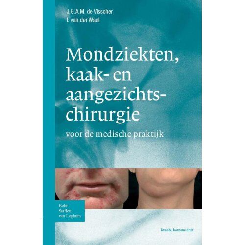 Springer Media B.V. Zakboek Mondziekten, Kaak- En Aangezichtchirurgie - Zakboek Ziektebeelden - J.G.A.M. de Visscher