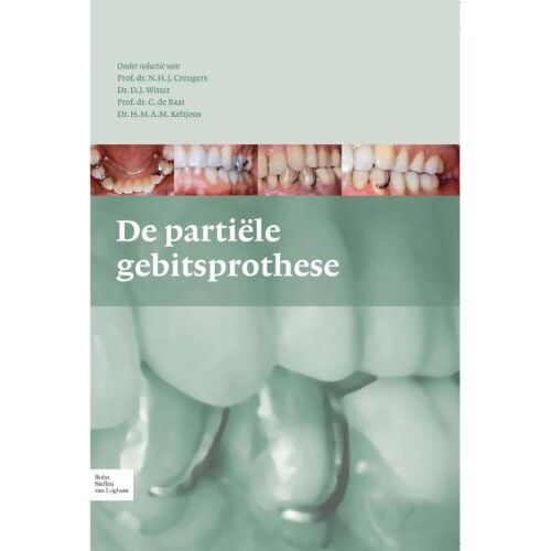 Springer Media B.V. De Partiele Gebitsprothese - N.H.J. Creugers