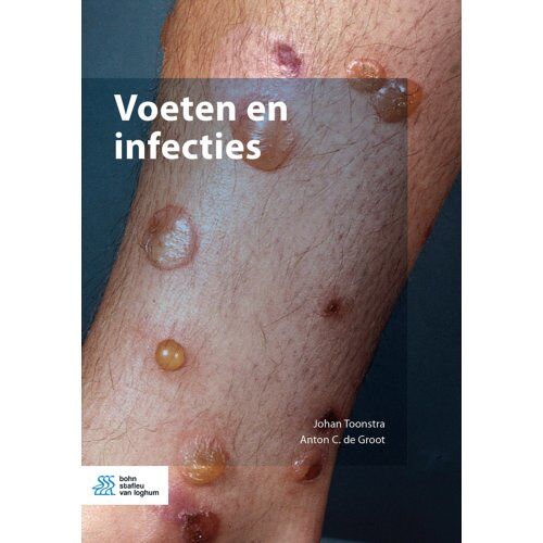 Springer Media B.V. Voeten En Infecties - Johan Toonstra