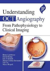 Lumbroso, Bruno Understanding OCT Angiography (1909836931)