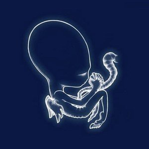 ADA Ágætis byrjun, płyta winylowa ADA Ágætis byrjun, płyta winylowa