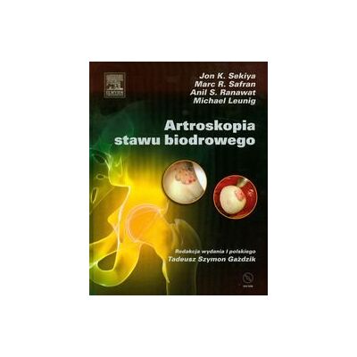 Artroskopia stawu biodrowego + CD Artroskopia stawu biodrowego + CD