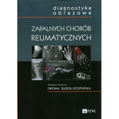 Diagnostyka obrazowa zapalnych chorób reumatycznych Diagnostyka obrazowa zapalnych chorób reumatycznych