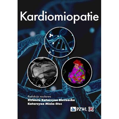 Kardiomiopatie Kardiomiopatie