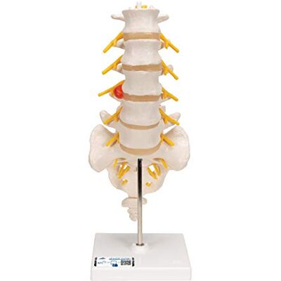 3B Scientific Modelo de coluna lombar – Vértebras lombares em tamanho real com demonstração de hérnia digital dorsolateral Smart Anatomy App (5 anos de garantia) 3B Scientific Modelo de coluna lombar – Vértebras lombares em tamanho real com demonstração de hérnia digital dorsolateral Smart Anatomy App (5 anos de garantia)