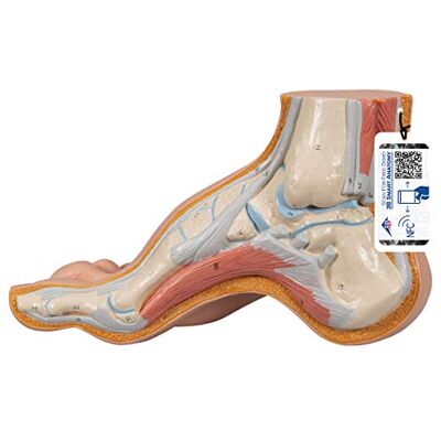 3B Scientific M32 Modelo de anatomia humana pé arqueado, Pes Cavus app de anatomia gratuita 3B Smart Anatomy 3B Scientific M32 Modelo de anatomia humana pé arqueado, Pes Cavus app de anatomia gratuita 3B Smart Anatomy