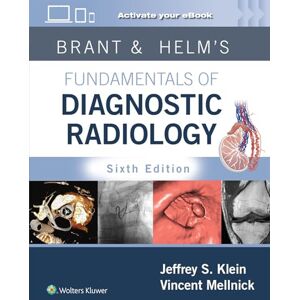 Klein, Jeffrey Brant & Helms' Fundamentals of Diagnostic Radiology: Print + eBook with Multimedia Klein, Jeffrey Brant & Helms' Fundamentals of Diagnostic Radiology: Print + eBook with Multimedia