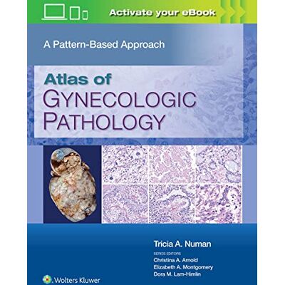 Tricia A. Numan Atlas of Gynecologic Pathology: A Pattern-Based Approach: Print + eBook with Multimedia Tricia A. Numan Atlas of Gynecologic Pathology: A Pattern-Based Approach: Print + eBook with Multimedia