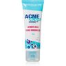 Dermacol Acne Clear creme gel fechar os poros 50 ml. Acne Clear