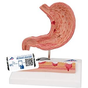 3B Scientific Lidská anatomie – žaludek se žaludečními vředy + bezplatná aplikace pro anatomie – 3B Smart Anatomy 3B Scientific Lidská anatomie – žaludek se žaludečními vředy + bezplatná aplikace pro anatomie – 3B Smart Anatomy