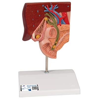 3B Scientific Lidská anatomie – model žlučových kamenů + bezplatná anatomie aplikace – 3B Smart Anatomy 3B Scientific Lidská anatomie – model žlučových kamenů + bezplatná anatomie aplikace – 3B Smart Anatomy