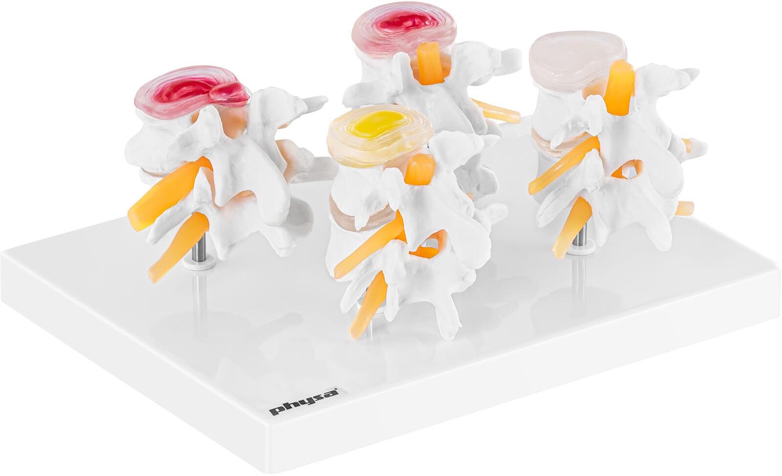 physa Lumbar Vertebra Model - can be dismantled into 4 parts - original size PHY-SM-7 physa Lumbar Vertebra Model - can be dismantled into 4 parts - original size PHY-SM-7