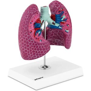 physa Lung Model - with pathologies PHY-LM-1