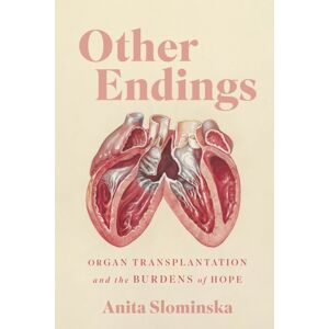 McGill-Queen's University Press Other Endings : Organ Transplantation And The Burdens Of Hope McGill-Queen's University Press Other Endings : Organ Transplantation And The Burdens Of Hope