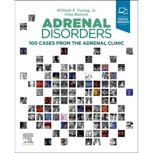 Elsevier - Health Sciences Division Adrenal Disorders : 100 Cases From The Adrenal Clinic Elsevier - Health Sciences Division Adrenal Disorders : 100 Cases From The Adrenal Clinic