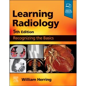 Elsevier - Health Sciences Division Learning Radiology : Recognizing The Basics Elsevier - Health Sciences Division Learning Radiology : Recognizing The Basics