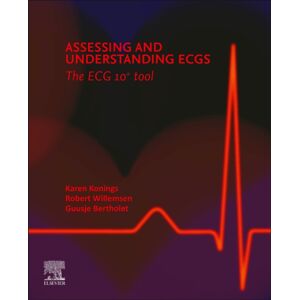 Elsevier - Health Sciences Division Assessing And Understanding Ecgs: The Ecg10+ Tool Elsevier - Health Sciences Division Assessing And Understanding Ecgs: The Ecg10+ Tool