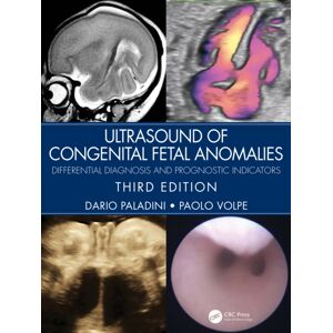 Taylor & Francis Ltd Ultrasound Of Congenital Fetal Anomalies : Differential Diagnosis And Prognostic Indicators Taylor & Francis Ltd Ultrasound Of Congenital Fetal Anomalies : Differential Diagnosis And Prognostic Indicators