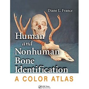 Taylor & Francis Ltd Human And Nonhuman Bone Identification : A Color Atlas Taylor & Francis Ltd Human And Nonhuman Bone Identification : A Color Atlas