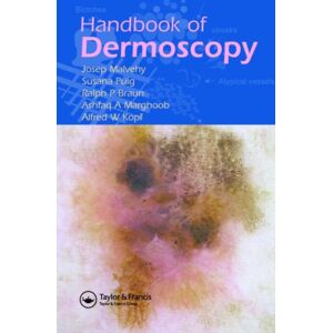 Taylor & Francis Ltd Handbook Of Dermoscopy Taylor & Francis Ltd Handbook Of Dermoscopy
