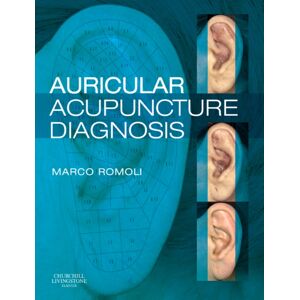 Elsevier Health Sciences Auricular Acupuncture Diagnosis Elsevier Health Sciences Auricular Acupuncture Diagnosis