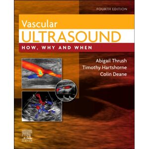 Elsevier Health Sciences Vascular Ultrasound : How, Why And When Elsevier Health Sciences Vascular Ultrasound : How, Why And When