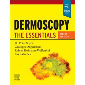 Elsevier Health Sciences Dermoscopy : The Essentials Elsevier Health Sciences Dermoscopy : The Essentials
